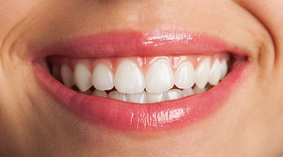 Smile after treatment